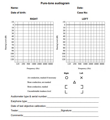 Deafness And Hearing Loss Toolkit Interpretation Of Investigations